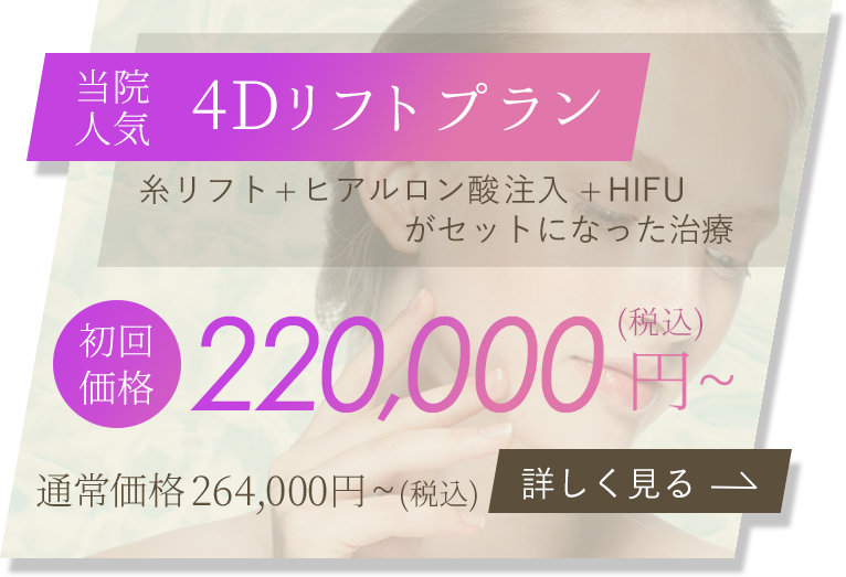 4Dリフトキャンペーン