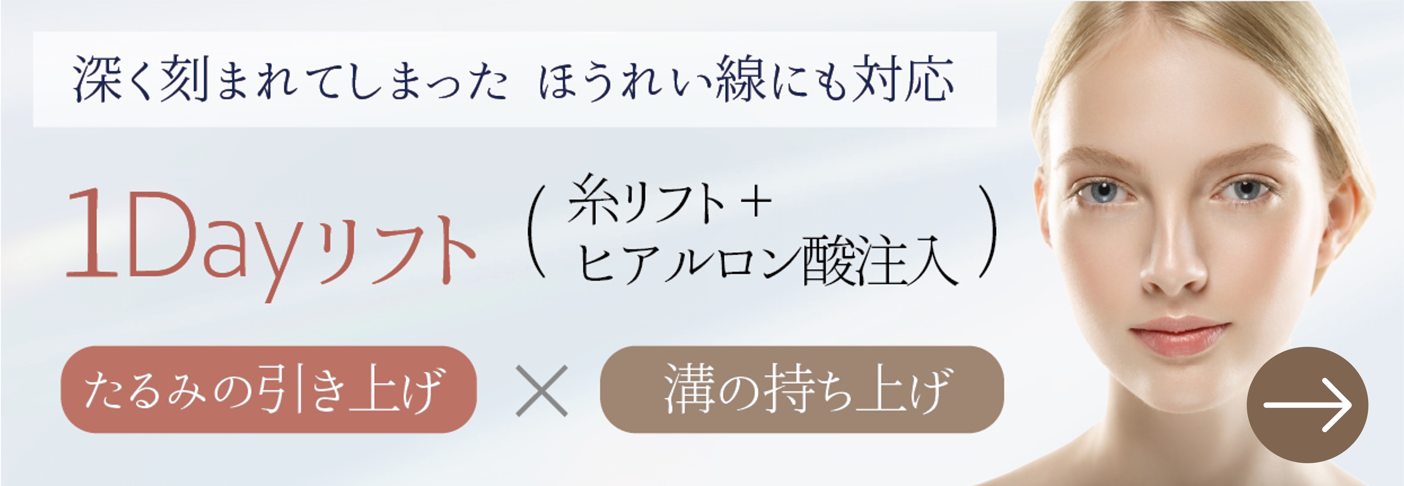 糸リフトとヒアルロン酸でたるみ改善