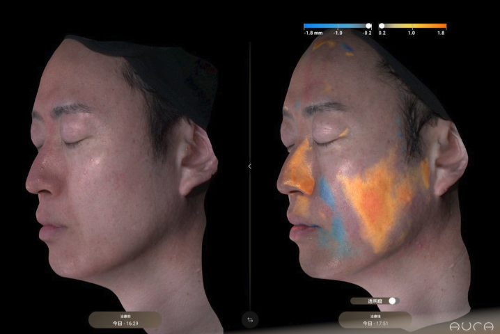 徹底した分析・治療結果の可視化