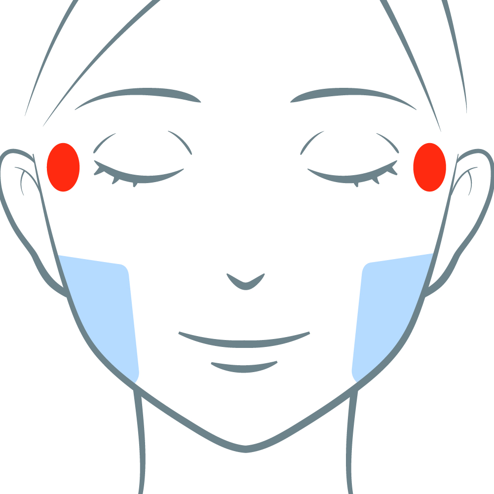 骨萎縮による頬コケ