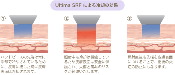 Ultima SRFによる冷却の効果