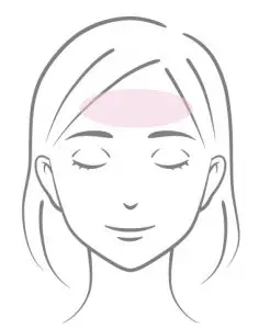 ソフウェーブの照射部位